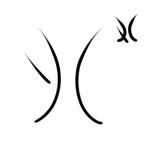File:Wacag-amputate.jpg